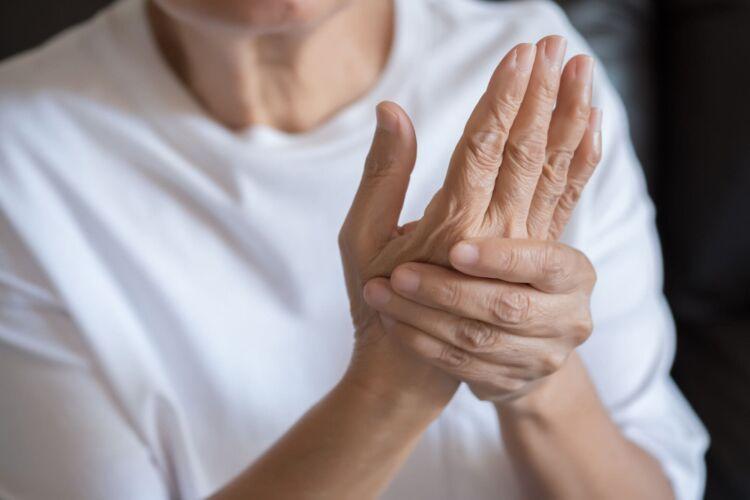 What is this Arthritis?